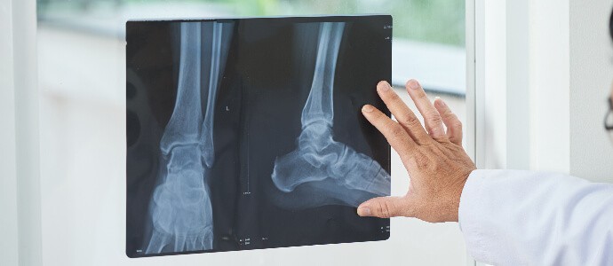 medical practitioner examining X-ray picture of legs near window in doctor's office looking at a broken bone injury