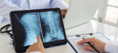 Doctor pointing out spine x-ray