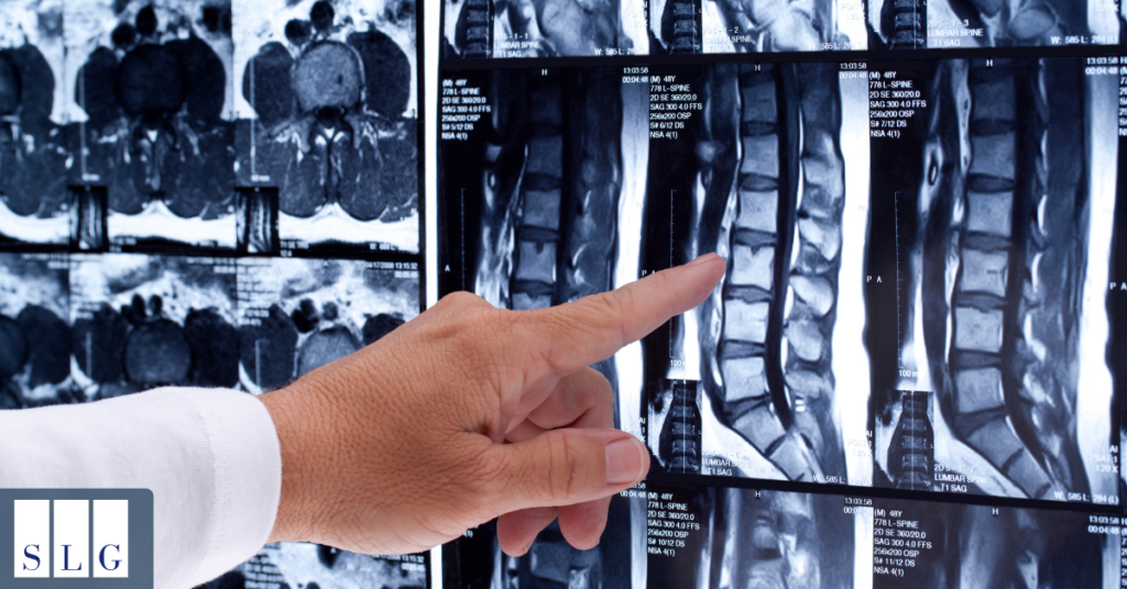 Doctor reviewing MRI scans for a lower back injury claim